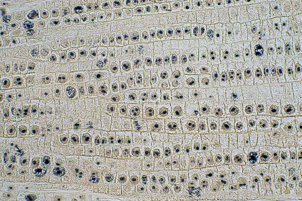 Soğanın Kök Ucu Mikroskop Görünümünde Kök Ucunda Mitoz Hücresini Göster — Stok fotoğraf