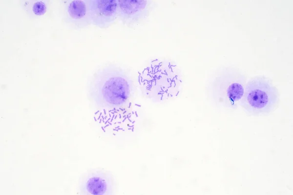 显微镜下观察血液中的人类染色体 — 图库照片