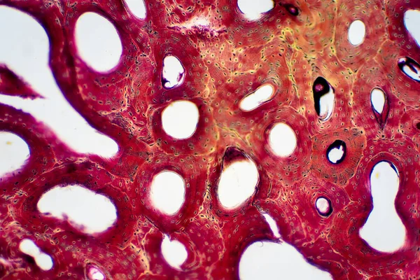 Histologia Tecido Ósseo Compacto Humano Sob Visão Microscópica Para Educação — Fotografia de Stock