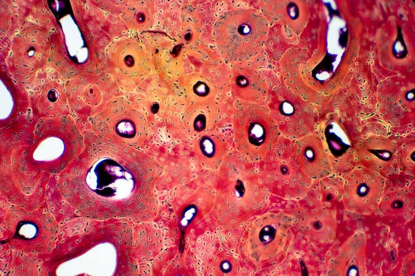 Histologi Mänsklig Kompakt Benvävnad Mikroskop Syn För Utbildning Muskelben Anslutning — Stockfoto