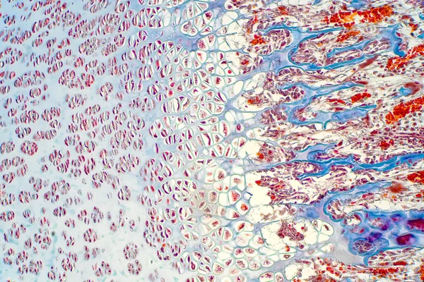 Cartilagine Tessuto Elastico Elastico Resistente Liscio Educazione Patologica Imbottitura Simile — Foto Stock