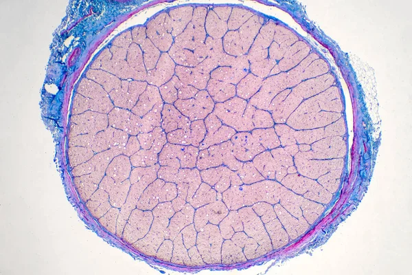 Nervo Ocular Humano Sob Visão Microscópio Histológico Para Patologia Humana — Fotografia de Stock