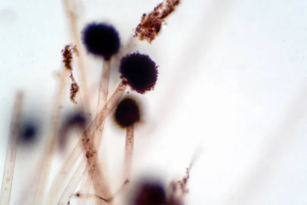 根粒菌 Rhizopus 一般的なサフロフィティック真菌の属である 顕微鏡下でのライゾプスパン型 — ストック写真