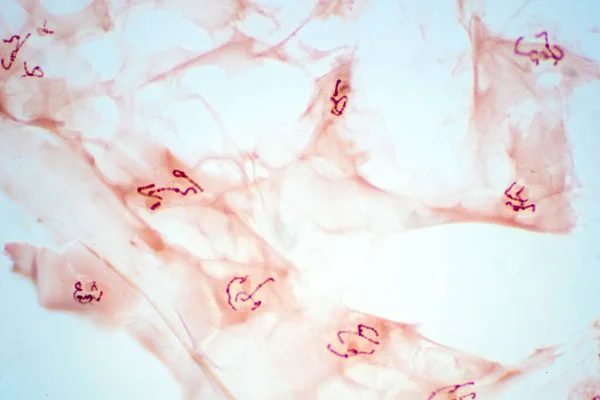 Salivkörtelceller Kromosomerna Mikroskopvyn För Utbildningspatologi — Stockfoto