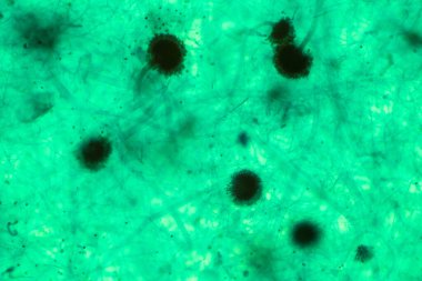 Rhizopus ekmek kalıbı mikroskop altında. Rhizopus yaygın bir saprofitik mantar cinsidir..