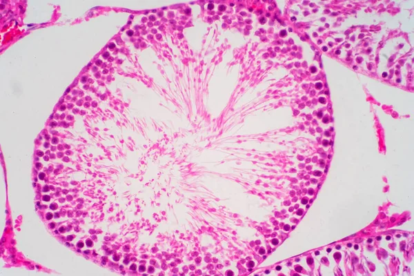 Esperma Humano Morfologia Testículo Microscópio Micrografia Mostrando Espermatozóides Para Educação — Fotografia de Stock