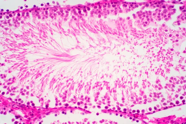 Esperma Humano Morfología Testicular Bajo Microscopio Micrografía Que Muestra Espermatozoides — Foto de Stock