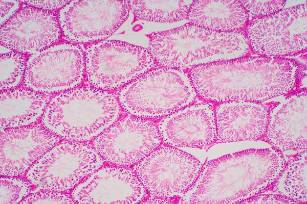 Sperme Humain Dans Morphologie Des Testicules Microscope Micrographie Montrant Spermatozoïde — Photo