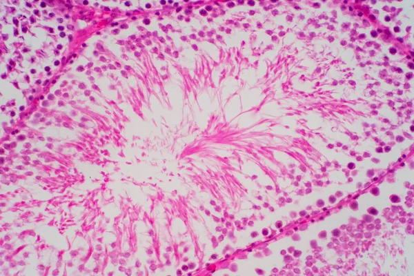 Spermatozoi Umani Nella Morfologia Del Testicolo Microscopio Micrografico Che Mostra — Foto Stock