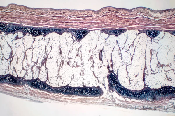 Osso Cartilagine Ialina Umana Microscopio Vista Educazione Patologia Fisiologia Dei — Foto Stock