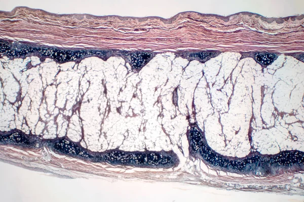 Osso Cartilagem Hialina Humana Sob Visão Microscópica Para Patologia Educacional — Fotografia de Stock