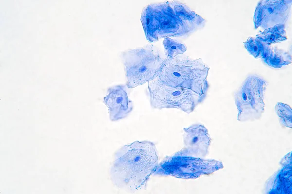 Human Cheek Epithelial Cells. The tissue that lines the inside of the mouth is known as the basal mucosa and is composed of squamous epithelial cells. Education pathology.