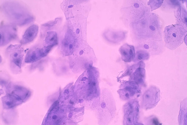 Human Cheek Epithelial Cells. The tissue that lines the inside of the mouth is known as the basal mucosa and is composed of squamous epithelial cells. Education pathology.