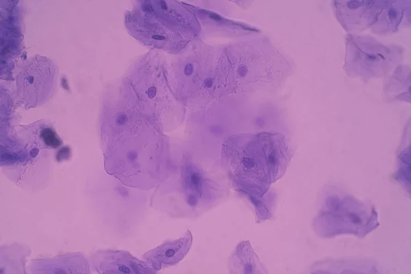Ανθρώπινα Επιθηλιακά Κύτταρα Ιστός Που Ευθυγραμμίζει Εσωτερικό Του Στόματος Είναι — Φωτογραφία Αρχείου
