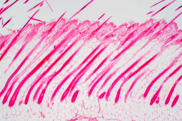 Tvärsnitt Mänsklig Hud Huvud Mikroskop Syn För Utbildning Patologi Histologisk — Stockfoto