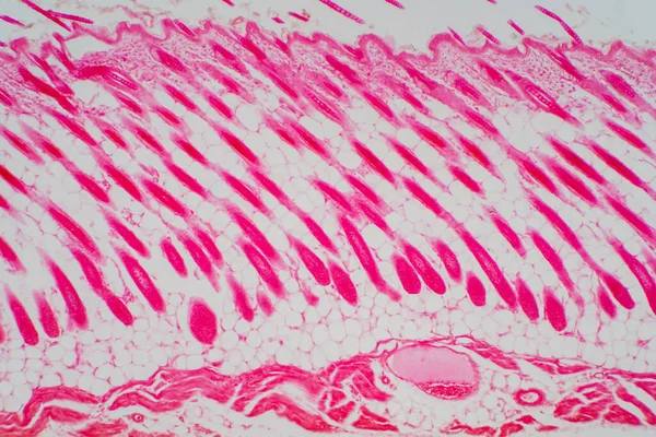 Cabeça Pele Humana Seção Transversal Sob Visão Microscópica Para Patologia — Fotografia de Stock