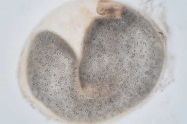 Ovos Fígado Verme Verme Parasita Sob Visão Microscópica Para Educação — Fotografia de Stock