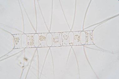 Chaetoceros mikroskop altında deniz planktonik diatomlarıdır..