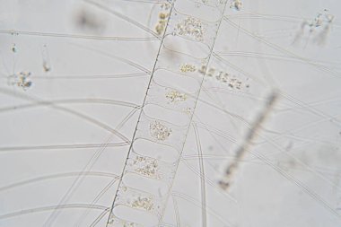 Chaetoceros mikroskop altında deniz planktonik diatomlarıdır..