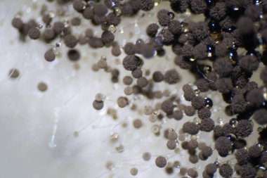 Eğitim için mikroskobik görünüm altında Aspergillus (küf).