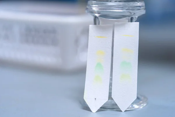 크로마토그래피 Paper Chromatography 실험실에서 물질이나 물질을 분리하는 사용되는 분석적 방법이다 — 스톡 사진