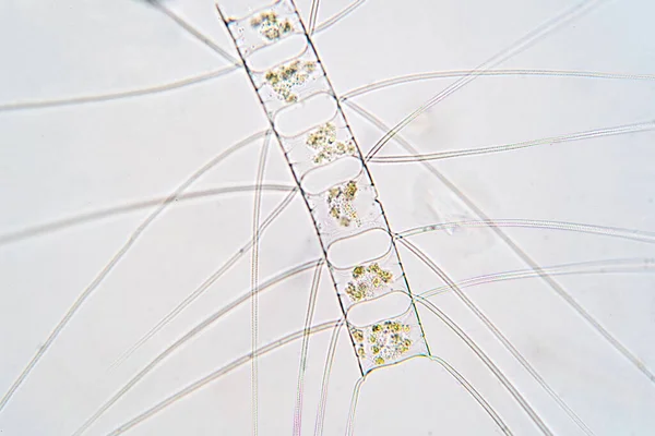 Chaetoceros Mikroskop Altında Deniz Planktonik Diatomlarıdır — Stok fotoğraf