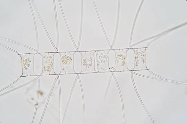 Chaetoceros Diatomáceas Planctônicas Marinhas Sob Visão Microscópio — Fotografia de Stock