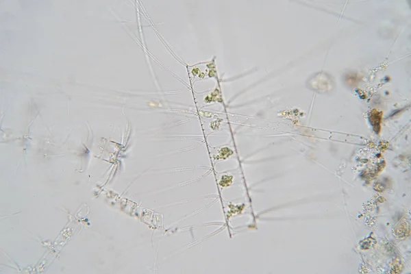 Chaetoceros Tengeri Planktonikus Diatomok Mikroszkóp Alatt — Stock Fotó
