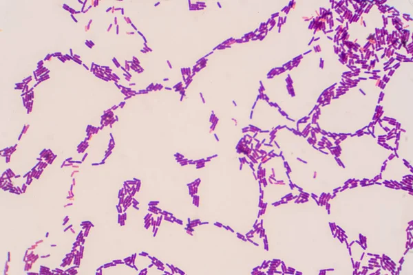 Bacillus Gram Positieve Vlek Onder Microscoop Bekijken Bacillus Staafvormige Bacterie — Stockfoto