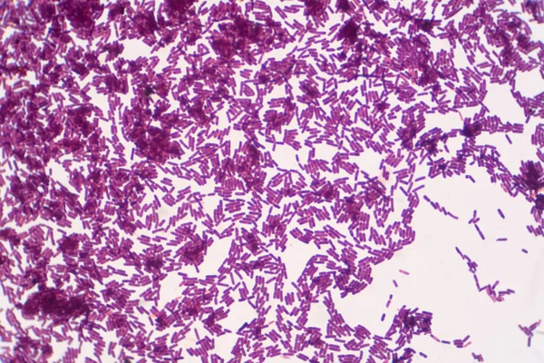 显微镜下的杆菌革兰染色阳性 芽孢杆菌是杆状细菌 — 图库照片