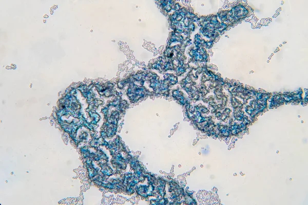 Saccharomyces Cerevisiae 현미경 아래에 성장하는 — 스톡 사진