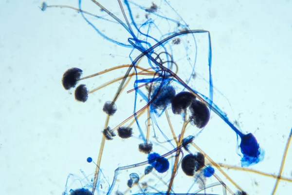 Rhizopus ekmek kalıbı mikroskop altında. Rhizopus yaygın bir saprofitik mantar cinsidir..