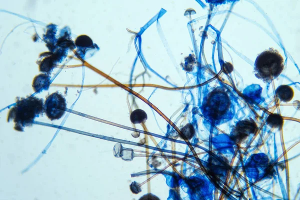 Molde Pão Rhizopus Sob Microscópio Rhizopus Gênero Fungos Saprófitos Comuns — Fotografia de Stock