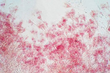 Mikrobiyoloji sınıfı eğitimi için mikroskopi altında penisilyum fungis.