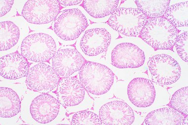 Mikroskop altında insan testisleri. Spermatogoni, mayoz, spermatid ve spermatozoa 'yı gösteriyor..