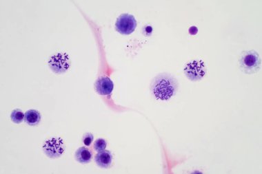 Eğitim için mikroskop altında kandan insan kromozomları.