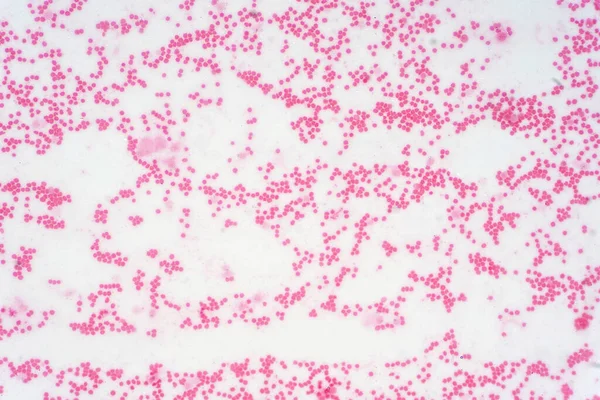 顕微鏡下でのヒト幹細胞の病理学的研究 — ストック写真