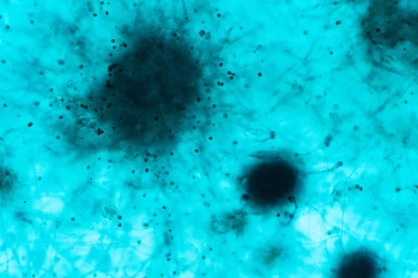 Aspergillus Pleśń Pod Mikroskopowym Spojrzeniem Dla Edukacji — Zdjęcie stockowe