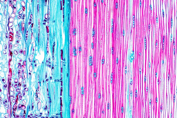 Struktura Histologiczna Pęczka Naczyniowego Pnia Sosny Pod Mikroskopem — Zdjęcie stockowe