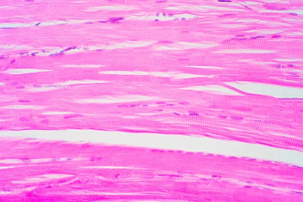 현미경으로 수있는 골격근은 병리학의 관점입니다 — 스톡 사진