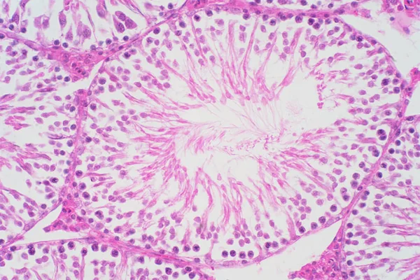Ludzkie Jądra Pod Mikroskopem Pokazuje Spermatogonia Spermatocyty Mejozie Plemniki Spermatozoa — Zdjęcie stockowe
