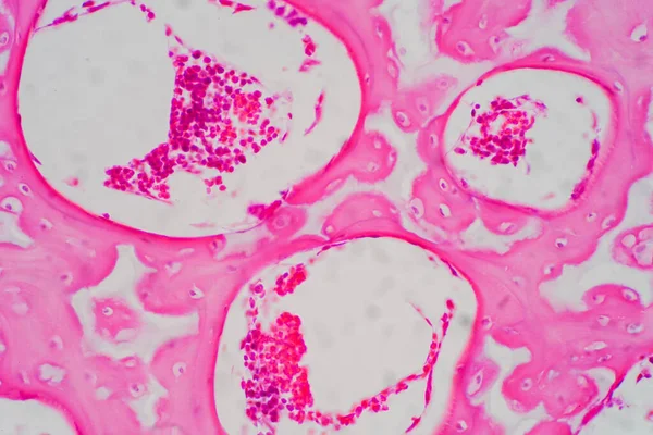 教育病理学のための顕微鏡下でのヒトのヒアリン軟骨 ヒト組織 — ストック写真