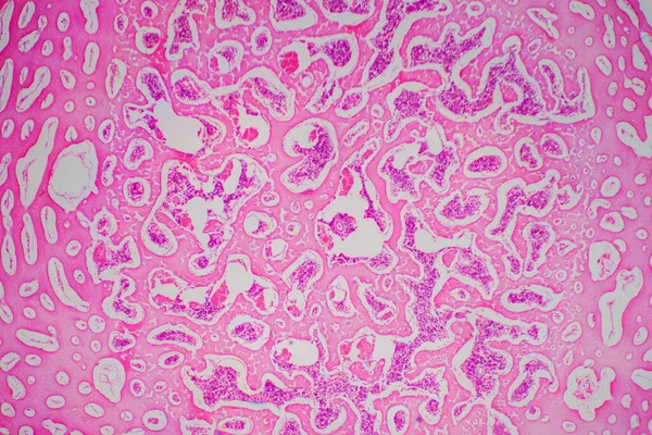 Osso Cartilagine Ialina Umana Microscopio Vista Educazione Patologia Tessuto Umano — Foto Stock