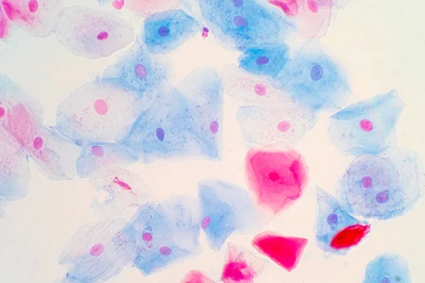 Emberi Méhnyak Laphámsejtjei Mikroszkóp Alatt Pap Kenet Teszt Egy Eljárás — Stock Fotó
