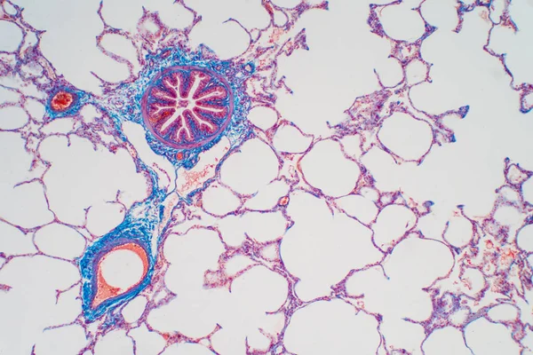 Lidská Plicní Tkáň Pod Mikroskopem Plíce Jsou Orgány Dýchacího Systému — Stock fotografie