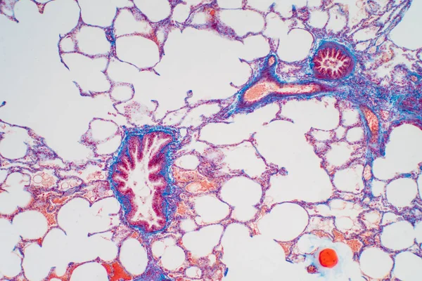 Lidská Plicní Tkáň Pod Mikroskopem Plíce Jsou Orgány Dýchacího Systému — Stock fotografie