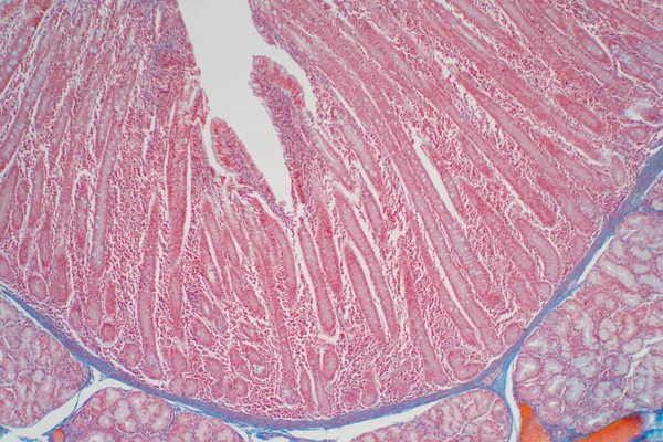 小腸の病理学からの十二指腸生検 人類史教育 — ストック写真