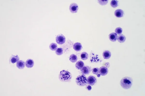 Emberi Kromoszómák Vérből Mikroszkóp Alatt Oktatási Céllal — Stock Fotó