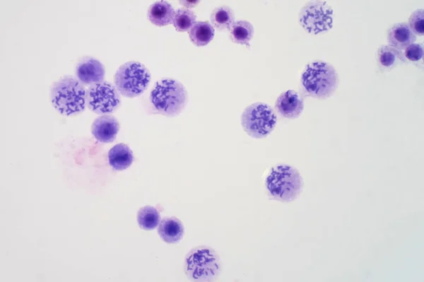 Cromosomi Umani Dal Sangue Microscopio Educazione — Foto Stock