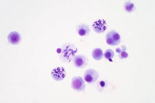 Cromosomi Umani Dal Sangue Microscopio Educazione — Foto Stock